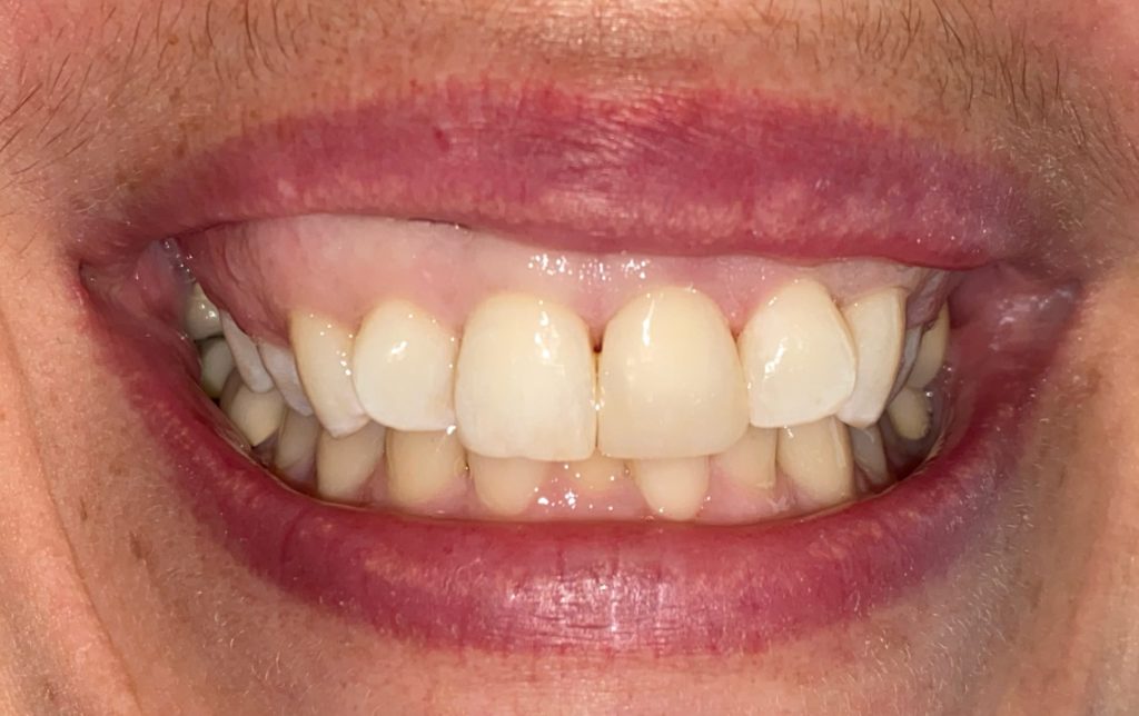 General Dentistry Service in Carstairs Dental Alberta