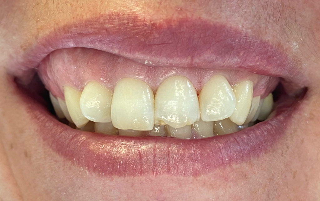 General Dentistry Service in Carstairs Dental Alberta