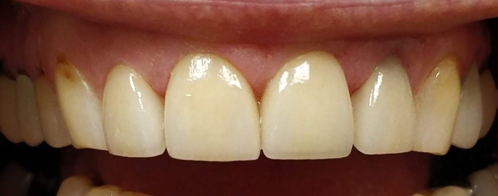 Cosmetic Dentistry Service in Carstairs Dental Alberta