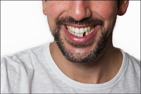 Adult Teeth Came In Late Or Delayed | Carstairs Dental Clinic | Dentist in Carstairs, AB