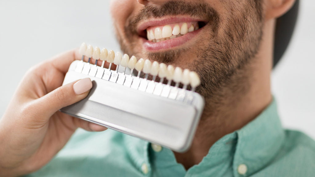 Affordable Dental Veneers, Dental veneers,