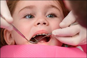 Dental filling services Dentist Carstairs Dental Alberta