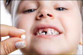 Early, Late, Or Irregular Loss Of Baby Teeth | Carstairs Dental Clinic | Dentist in Carstairs, AB
