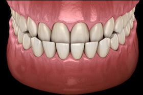 general dentistry carstairs - dentist clinic alberta