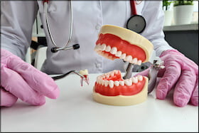 Wisdom Teeth Extraction Dentist Carstairs Dental Alberta