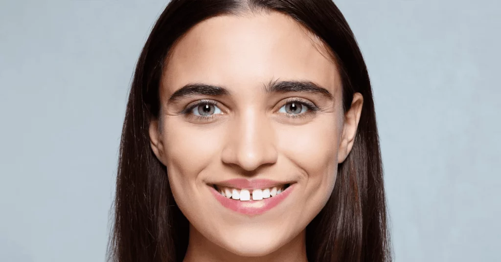How to Fix Gaps in Your Teeth: A Comprehensive Guide to Diastema Treatment