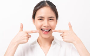 choosing the right type of braces for overbite correction