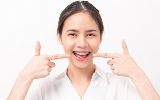 choosing the right type of braces for overbite correction